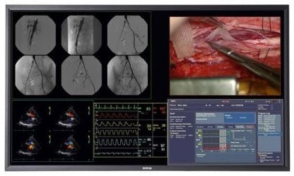 Barco Surgical/OR &amp; Flat Panel Displays