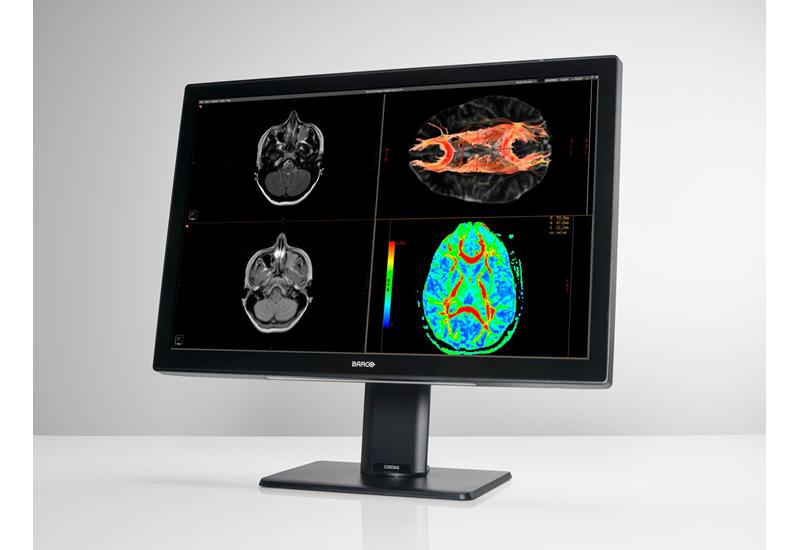 Diagnostic-Barco CORONIS 4MP FUSION COLOR