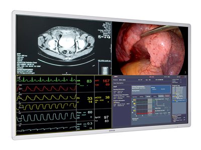 55" Surgical Display MDSC-8255