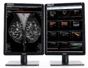 Mammography-Nio Color 5.8MP-2H MDNC-6121