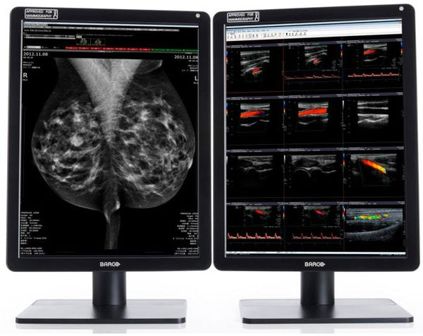 Mammography-Nio Color 5.8MP-2H MDNC-6121