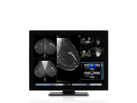 Coronis OneLook 32MP-1H with MXRT-8700 Graphics Card
