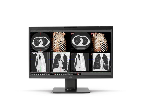 Barco Nio 8MP (MDNC-8132)