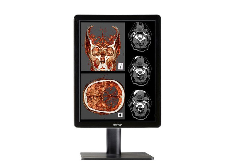 NIO 2MP COLOR LED 1H MXRT2600